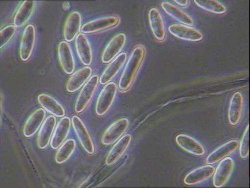 Image 3: Sarcoscypha coccinea spore4